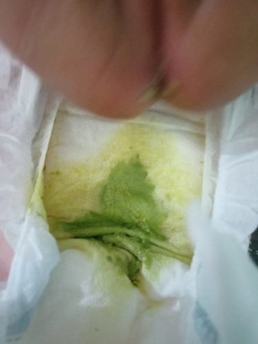 Green poop