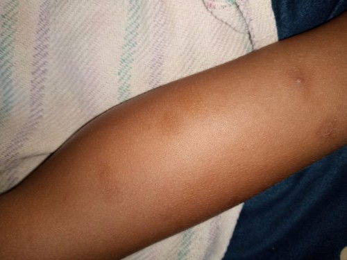 Tanya seputar kulit anak