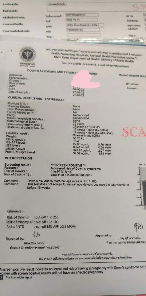 กังวลคะสอบถามแม่ๆ ที่ตรวจคัดกรองดาวน์ซินโดรม