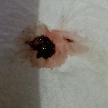 Keluar flek di usia 37week