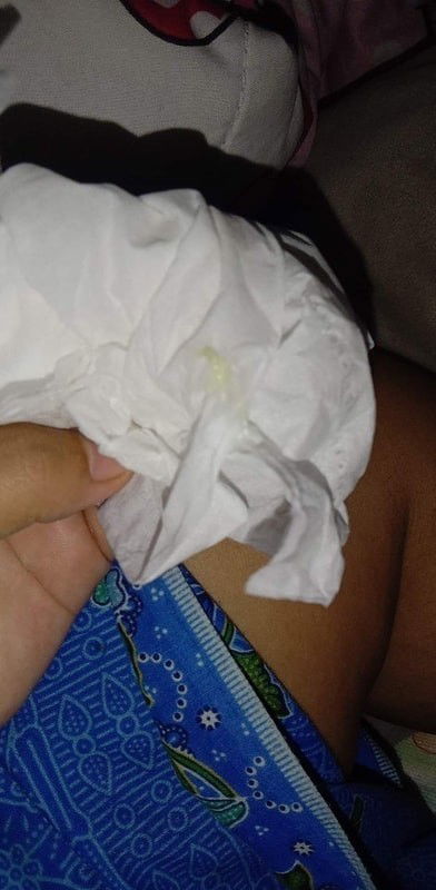 แบบนี้เรียกว่ามูกมั่ยคะแม่ออกมาไม่เยอะคะเป้นสีขาวผสมสีเขียวเล็กน้อยคะไม่มีอาการคันร่วมคะแบบ