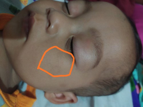 Bintik bintik keunguan