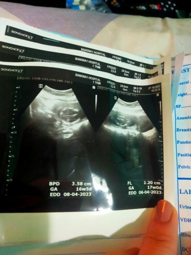 แม่ๆช่วยดูให้หน่อยค่ะมันคือส่วนไหนของเด็กคะท้อง 4 เดือนแล้วหมอซาวไม่รู้เรื่องเลยถามอะไรก็ไม่ได้คำตอบ