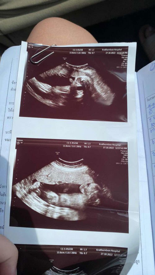 28 W  น้องกลับหัวแล้ว