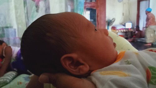 Tentang bentuk kepala bayi