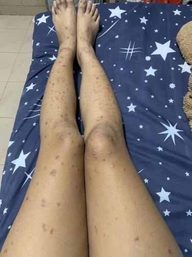 อยากสอบถามแม่ๆค่ะ ขออภัยในการลงรูปถามค่ะ🙏🏻