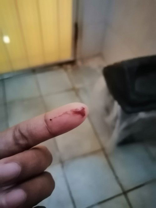 ท้อง​3เลือด​ขุน​