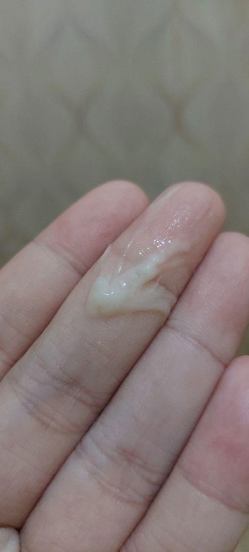 Keputihan atau Ketuban?