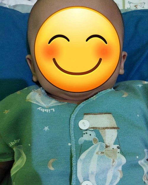 Telinga anak kanan kiri berbeda