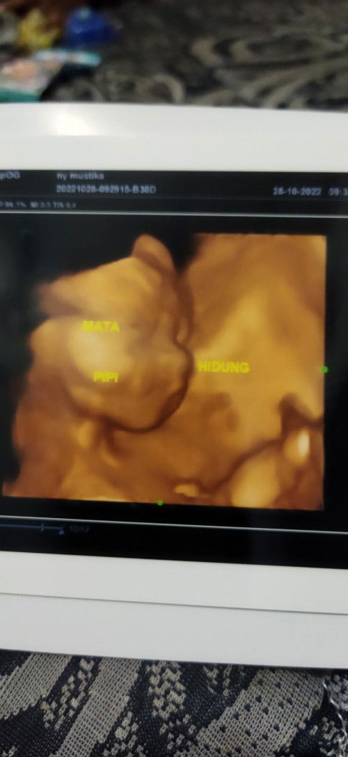 Baby 6 bulan atau 24weeks