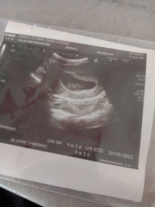 Scan baby 9week tapi tiada denyutan🥺