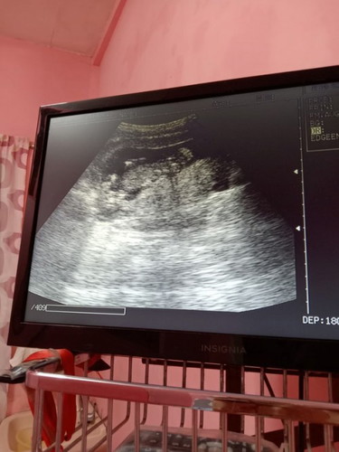 Hi im 14 weeks now kaka pacheckup kolang yesterday. and sabi ni ob malaki si baby for 3months