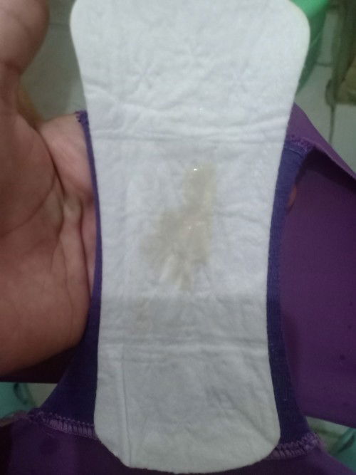 Mucus Plug or Normal Discharge