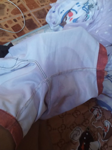 มีน้ำเดินแต่ไม่มีอาการอื่นๆ