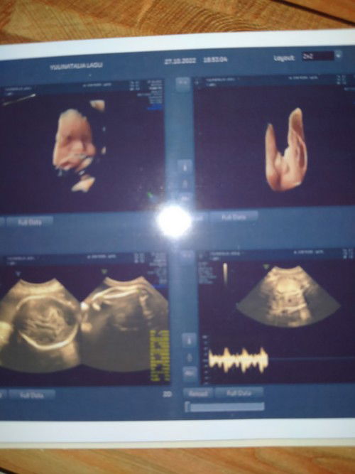 Sering yok Bun
Hpl Desember Uda brp week