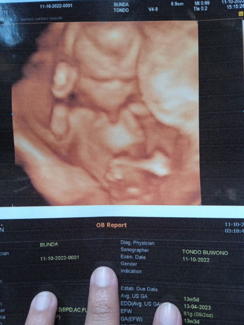 Share foto buat kenang2an bunda