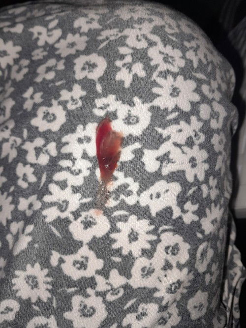 Mucus Plug naba to mga momsh