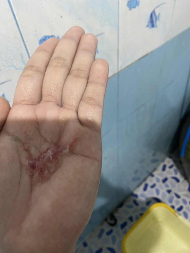 แบบนี่คือมูกเลือดใดล้คลอดไหมคะ