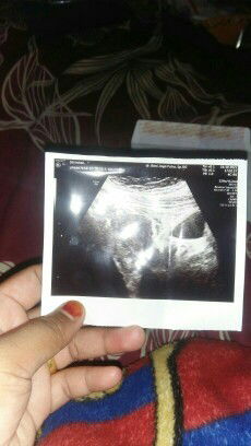 Tolong bntu jawab bun