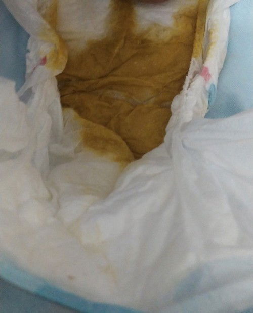 Bab kuning encer agak berbusa