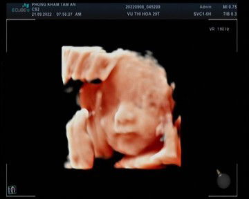 Cho m hỏi vs.uống thuốc chống co thắt tử cung có tốt k a.mk đc 35 tuần bị gò nhiều nên mk mua thuôc