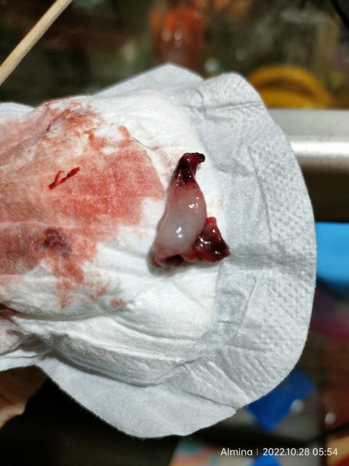 apakah ini keguguran bun?