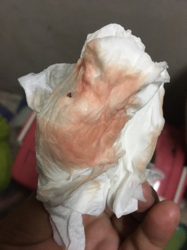 ขอสอบถามแม่ๆ หน่อยค่ะ พอดีเป็นแม่มือใหม่ น้องพึ่งได้ 37 สัปดาห์ มีเลือด และมูกขาวใสออกมานี่อันตรายไหมค่ะ
