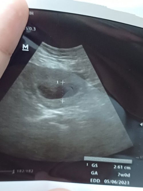 Hpht 24 agustus 2022 belum kelihatan janin