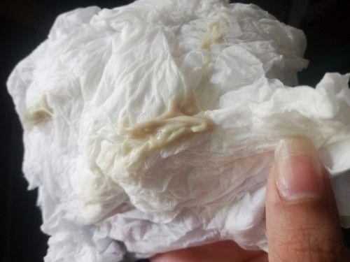 แบบนี้เรียกว่าอะไรคะ เป็นอันตรายหรือคะ