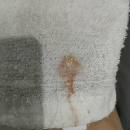 implantation bleeding?? 6 weeks??