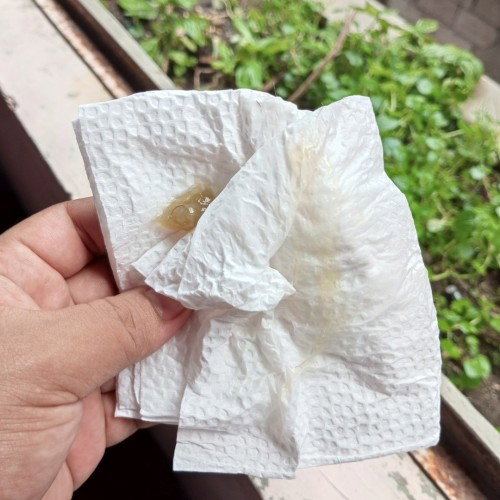 DISCHARGE COLOR, ANO PO IBIG SABIHIN NTO?