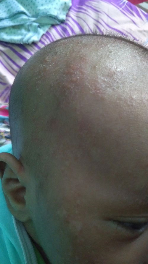 bismillah
assalamualaikum 
bun cara nyembuhinnya gimana ya???