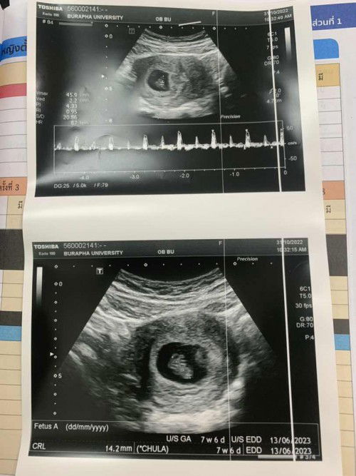 ซาวเจอน้องน้อยตอน 7w6d