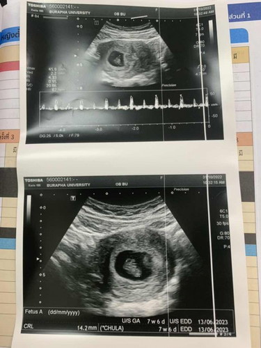 ซาวเจอน้องน้อยตอน 7w6d