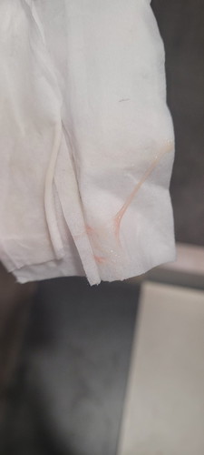 Mucus plug po ba?