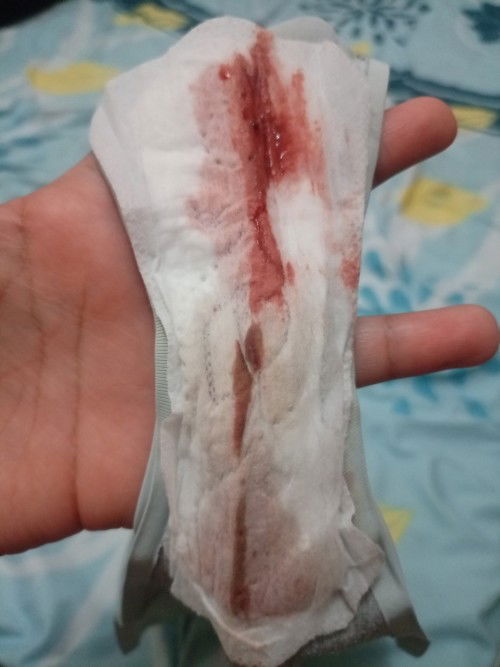 Darah keluar di 9w6d