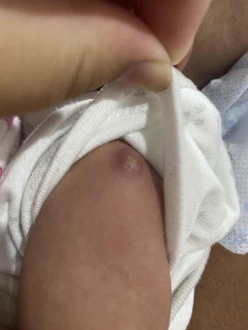 ไม่ทราบทำไม่อยู่ๆเป็นแบบนี้คะลูก1เดือนเต็ม