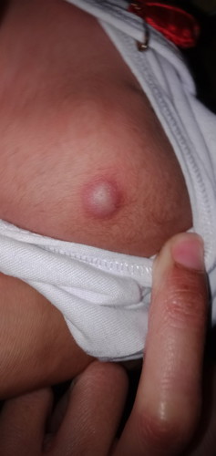 Hello good evening mga miii,help nman po nakaranas na po ba ang mga baby nyo po ng ganto?
Pa help..
