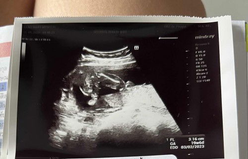 การตั้งครรภ์เดือนกุมภาพันธ์