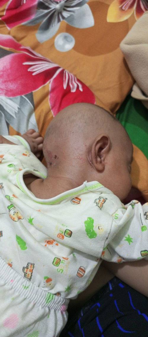 Nanya seputar kesehatan kulit anak