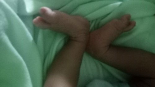 Kaki bayi terlalu menekuk keatas