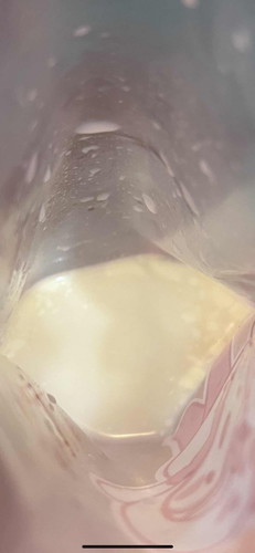 นมแม่แช่แข็งช่องฟรีซไว้ เอามาละลายในน้ำอุณหภูมิปกติ แล้วเป็นแบบนี้ปกติมั้ย