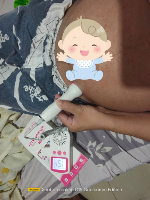 30 weeks position ni baby base sa heartbeat?