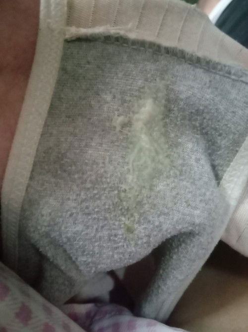 คุณแม่คนไหนเป็นตกขาวแบบนี้บ้างคะ