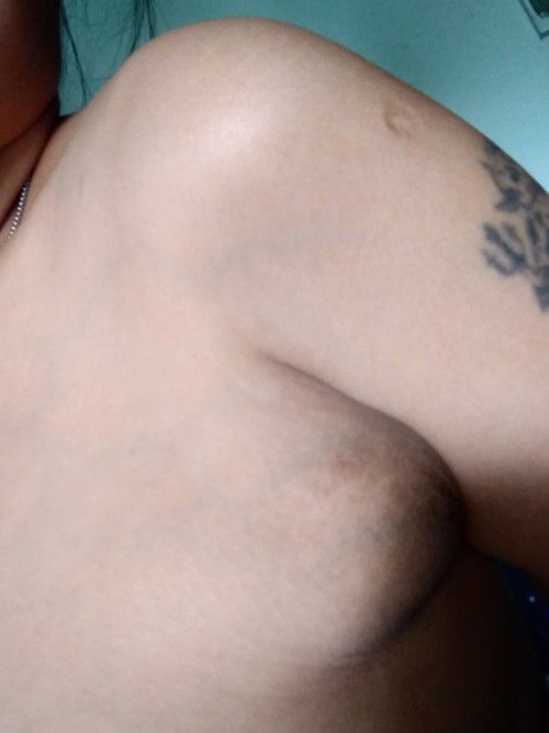 ก้อนใต้รักแร้