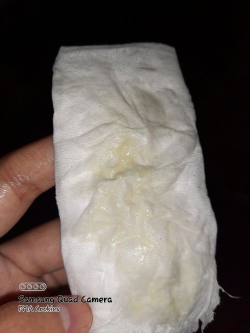 Keluar cairan seperti keputihan
