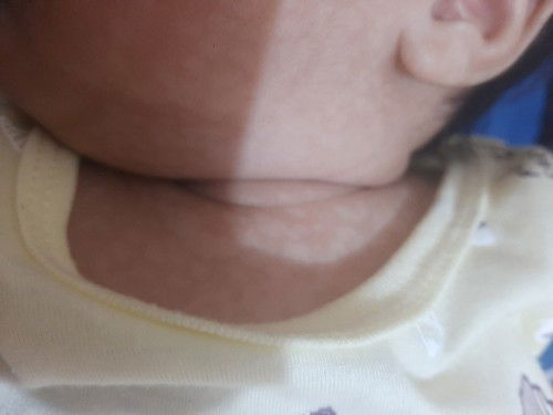 Puti puti na parang an-an