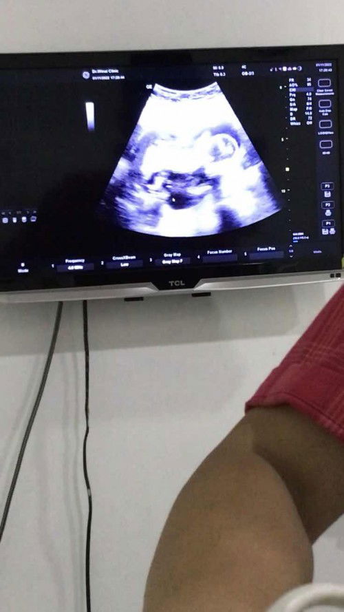 แม่ๆเห็น ช่วยดูหน่อยค่ะว่า เห็นเพศไหม