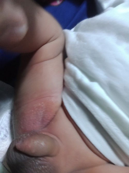 Ano po Ang dapat kong gawin sa ganitong Case ?