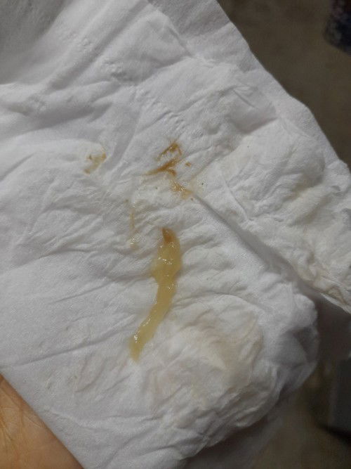 มีมูกออกมาจากช่องคลอด